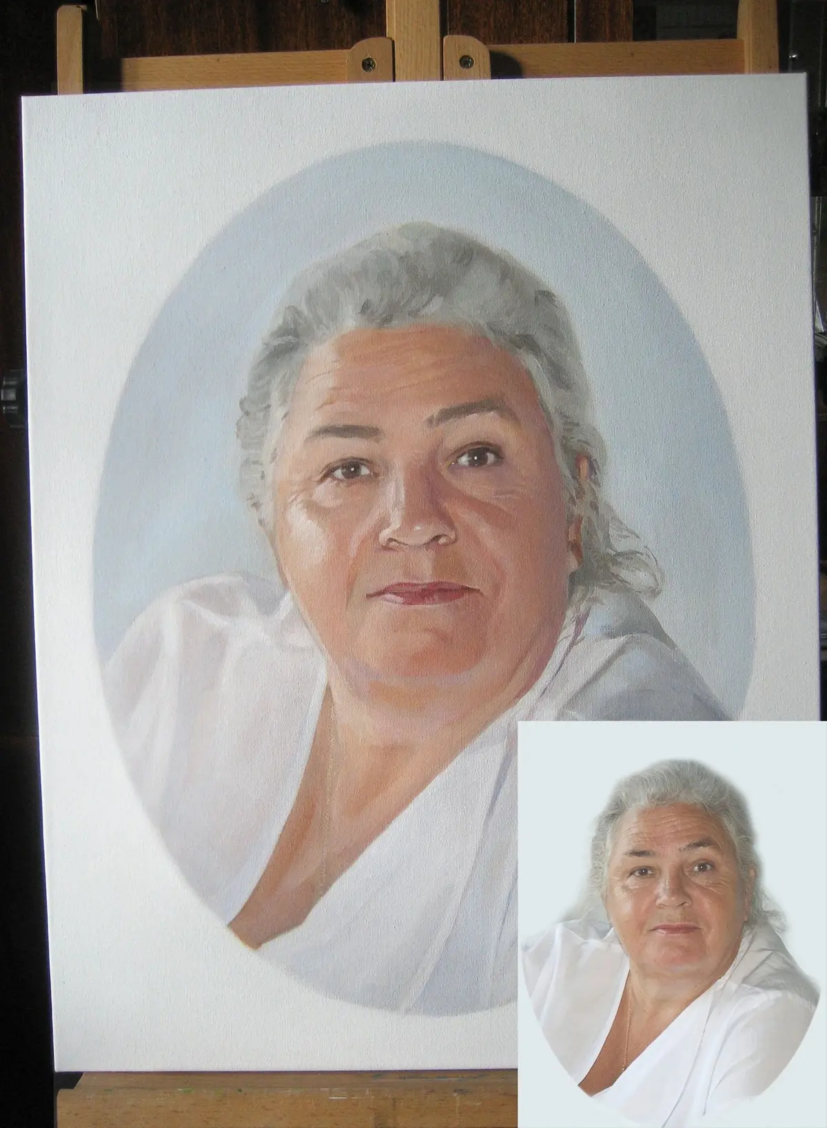 Wandbilder Stirn, Nase und Wange s34635