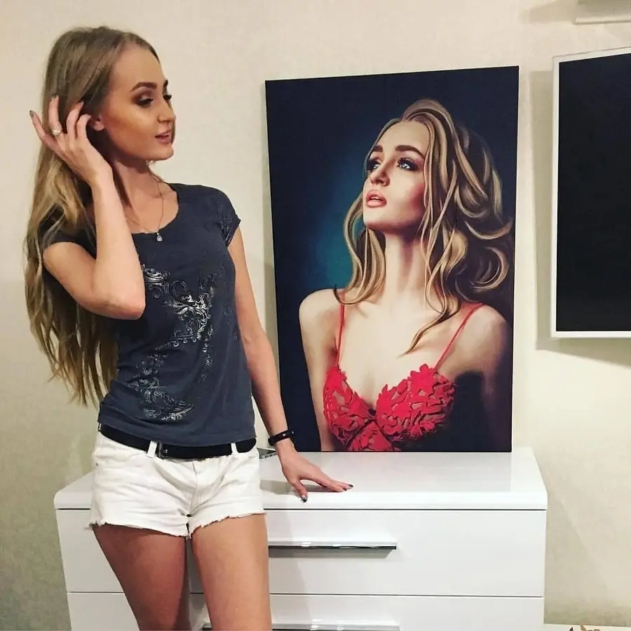 Wandbilder Gelenk-, Schulter- und Blitzlichtfotografie s34637